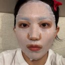 페페.J | [쌍수일기_5화]수술3주-2개월후/소세지눈 잘가고~왕방울눈 어서오고~(비절개눈매교정+매몰법+윗트임후기)