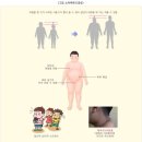 소아비만 진단 및 치료 #대체치유 : #한국녹색문화협회 이미지