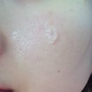 [은블리의 오끌레어 안티블레미쉬 울트라 세럼 후기]