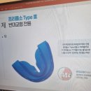 혁신꿈소아치과의원 | [소피일기] 탠이교정일기 부정교합교정 2주차