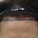 압구정맘모스헤어라인의원 이미지