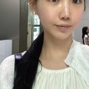 (주)포트라 | 홍대) 다운타임없는 “포트라리프팅” 솔직 후기 | 티타늄 비교 | 전후 | 부작용,주의사항