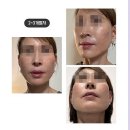 올케어성형외과의원 이미지