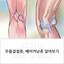 통로베이커 네이버블로그