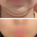 블루밍의원 이미지