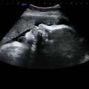 수정-35 | 13. 임신 35~37주 임산부 일기 (산전마사지/ 임신 후기 증상 _배뭉침,가진통,환도선다)