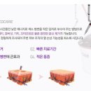 피코메드 이미지