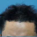 마인드닥터의원 | 비절개 3100모 가격(비용), 박운 원장의 철학