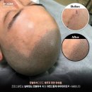 프로스칼프부산 이미지
