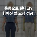 (주)이지메디컴 100세동안 | 성신여대 필라테스 / 팔꿈치 외반주 교정 체형 불균형 개선 통증 완화까지 성공한 사례!