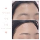 썬헤어라인 이미지