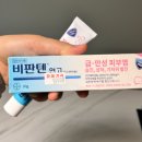 장기반점 | 피부건선 치료 얼굴 붉은반점 해결후기