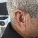 와이덱스 보청기 울산 남구점 | 울산보청기 지원금 제도와 26년 개정된 포낙보청기 라인업