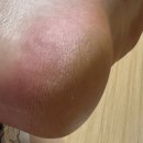 메디레스큐 이미지