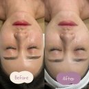 화명대우푸르지오아파트경로당 | ［부산/화명］부산 화명동 피부관리 프라이하우트전문점 온리에스테틱 웨딩관리 찐 후기