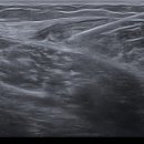 송도마취통증의학과의원 이미지