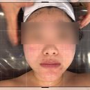 오늘은봄날 | 평택피부관리 잘하는 곳 봄날에스테틱 비전동 수분케어 피부진정 후기
