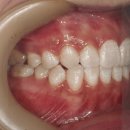 바닐라치과의원 이미지