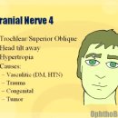 Trochlear nerve palsy 이미지