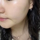 25시카 | 에이시카 시카흔적 세럼 에스트라 7일 체험 샘플링 KIT 사용해본 후기