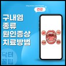 허정신건강의학과의원 | 잇몸 혀 구내염 빨리 낫는 법 약 치료 방법 기간은?