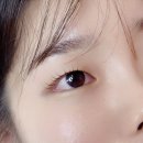 펌] 무쌍눈에도 자연스럽고 유지력 좋은 “유앤비” 후기 (전/후 비교) | 시술 후 관리 주의사항 정리