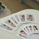 아크성형외과의원 | [아크성형외과] 윤곽핀 제거 받은 후기!