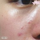 수아영
