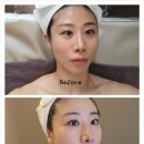 [광교피부관리]광교이의동피부관리 스파에테르노 수분탄력관리 후기