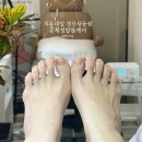 치유네일 | 경산무좀발톱, 문제성 발톱 건강한 발 되찾기 치유네일에서 관리받은 후기