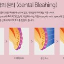 미백세탁 이미지