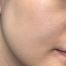 프롬비건 | [뷰티] 아크메르 프롬인그리디언트 화이트닝 앰플 후기, 민감성 피부도 부담 없었던 아침 미백앰플