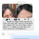 전주두피문신 여성가르마 후기♥️ 이미지