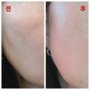 코디의원 | 부산 경성대역 피부과 의원 부산올리디아 방문 후기