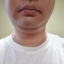 플래너성형외과의원 | 강남역성형외과 플래너성형외과 상담후기