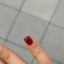 오송프라자약국 | 오송 더순수의원 손가락 염증 진료 후기
