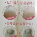 엣지오브넬 이미지