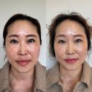 피부샵 원장이 추천하는 미백화장품 / 비타민C앰플 브라이트닝탄력크림 유니앤코어후기
