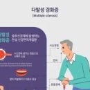 다발성 경화증 다발성 경화증 원인 다발성 경화증 초기 후기 다발성 경화증 패턴 이미지