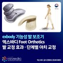 (주)아치소프트 | 평발·무지외반·족저근막염 등 12가지 발 질환에 적용되는 원내처방 엑스바디 기능성 발보조기 [exbody...