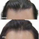 양재역 근처 반영구 전문 아카데미 &amp; 양재 두피커버 헤어라인 만족 후기 &#34;에디뷰티 코리아 (EDDY Beauty...