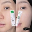 율약국 | 셀트리온 지피덤 EGF 크림 | 국내 최대 이지에프 10ppm 일주일 사용 후기