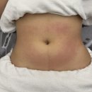 이마트24 부천소사본동점 | [부천 피부샵] ‘올가드림뷰티 소사본동점’ 복부순환관리 솔직후기