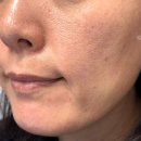 정도글로벌㈜ | 슬로우에이징 뷰티템 바이오힐 보 프로바이오덤 콜라겐 리모델링 세럼 &amp; 3D 리프팅 크림 사용후기