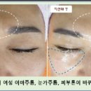 라파테라피 이미지
