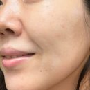 베스트메디필 이미지