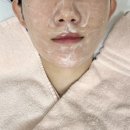 검암 &#39;미오뷰티&#39;에서 바이오폭스 마이크로젯 시술로 모공, 잡티케어한 후기 - 1회차 비포/애프터