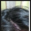 바로스탑한의원 이미지