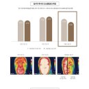 강릉인셀덤 | 인셀덤효과:) 인셀덤리뉴얼후기