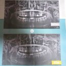 도봉美치과의원 | 도봉구임플란트치과, 치료 결과가 달라지는 선택 기준